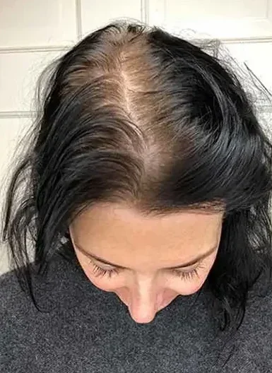 Lastuce-naturelle-et-magique-pour-stopper-la-chute-de-cheveux_-1200×628 Lastuce-naturelle-et-magique-pour-stopper-la-chute-de-cheveux_-1200x628